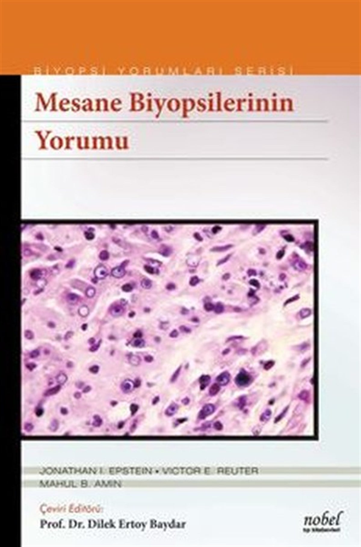 KolektifTıpBiyopsilerin Yorumu: Mesane