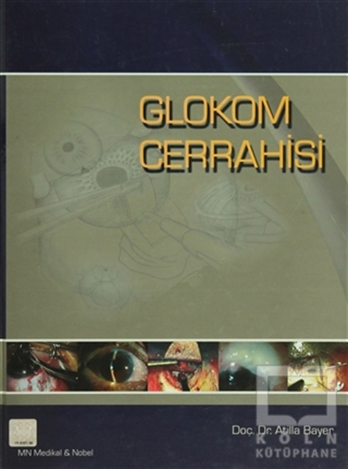 Glokom Cerrahisi