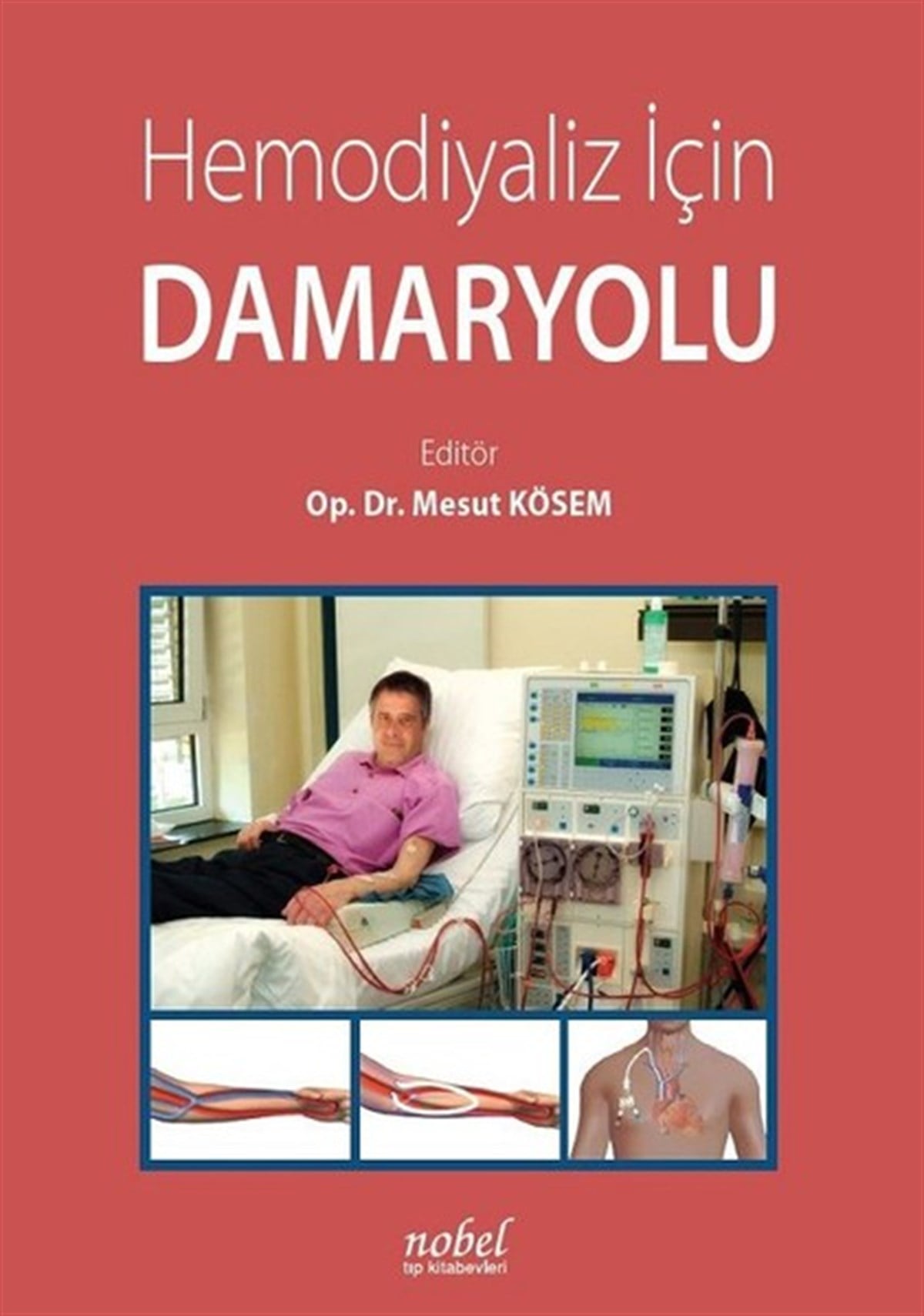 KolektifTıpHemodiyaliz İçin Damar Yolu
