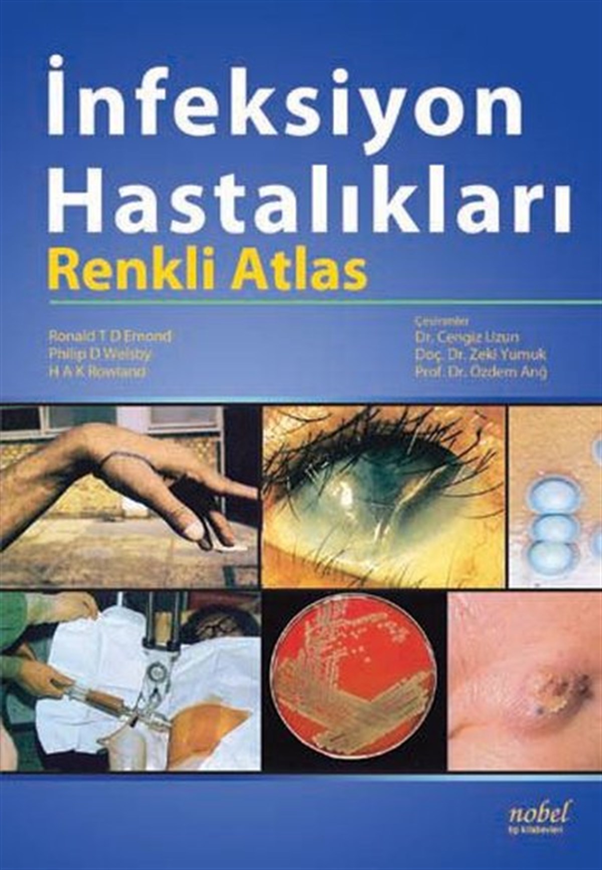 KolektifTıpİnfeksiyon Hastalıkları Renkli Atlası