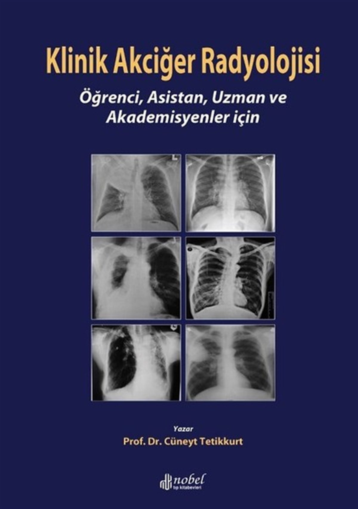 Prof.Dr. Cüneyt TetikkurtTıpKlinik Akciğer Radyolojisi
