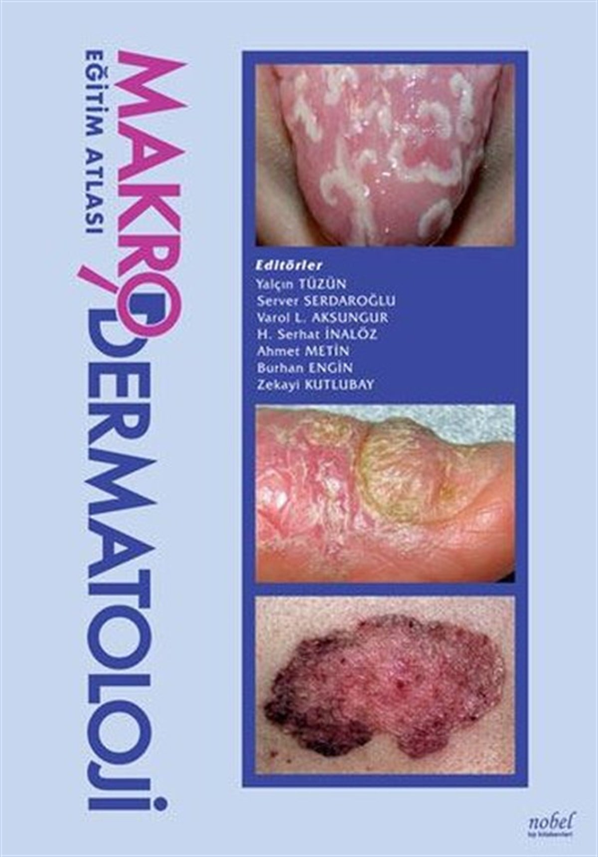 KolektifTıpMakrodermatoloji Eğitim Atlası