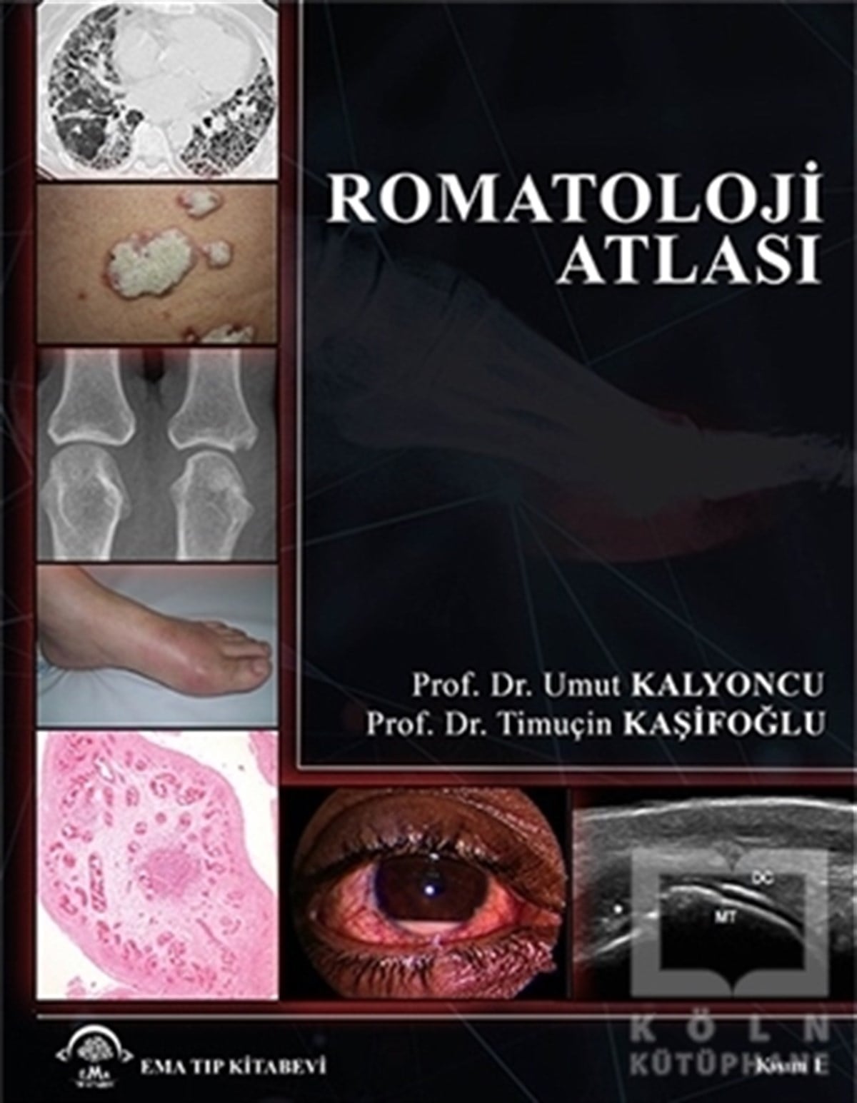 Umut KalyoncuBaşvuru KitaplarıRomatoloji Atlası