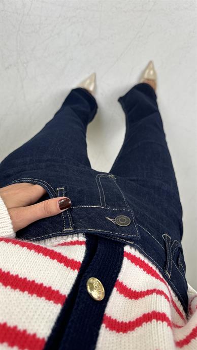 Pembe Çizgili Gold Düğmeli Hırka