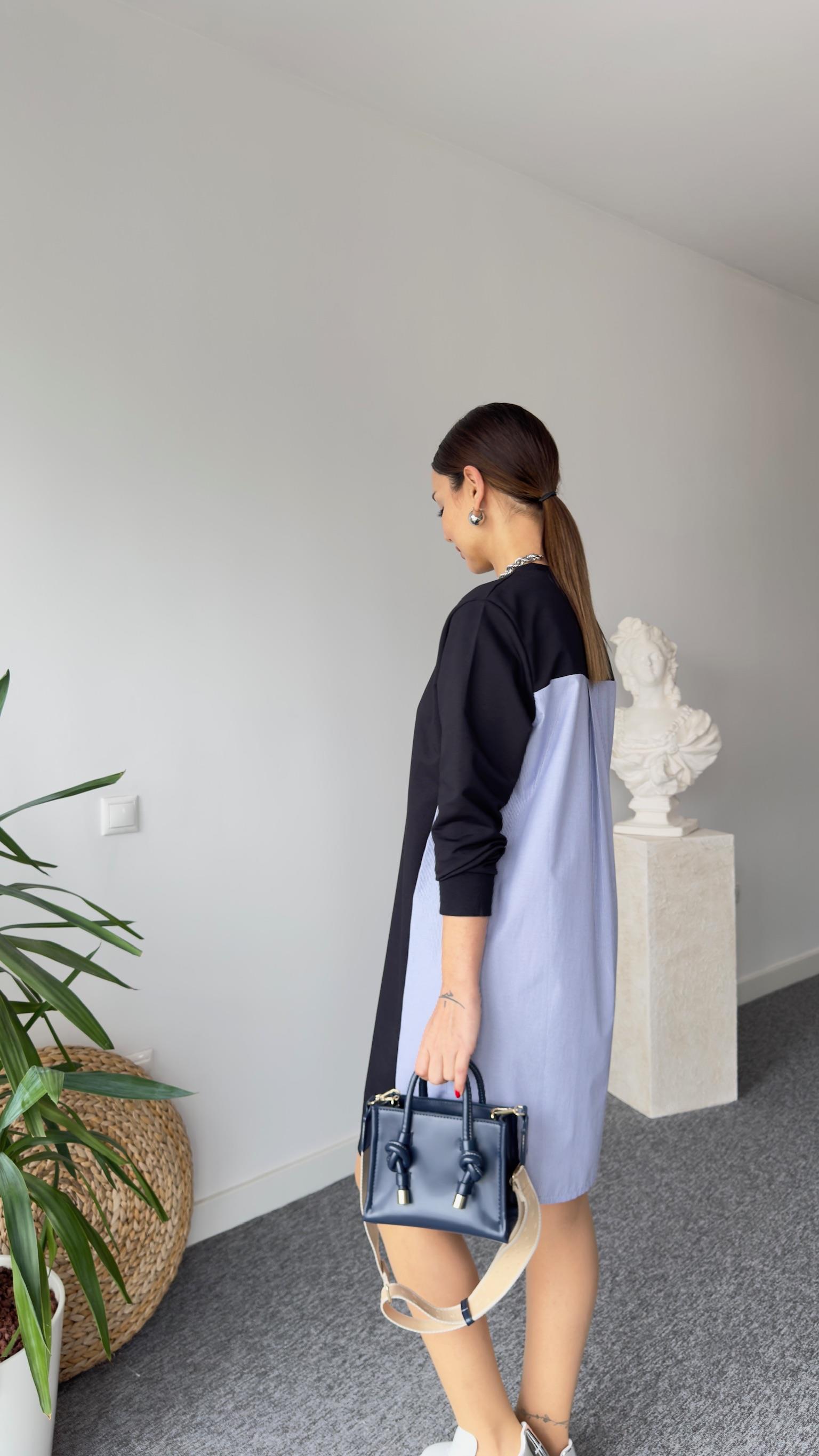 Sırt Çizgili Poplin Detay Basic Elbise 