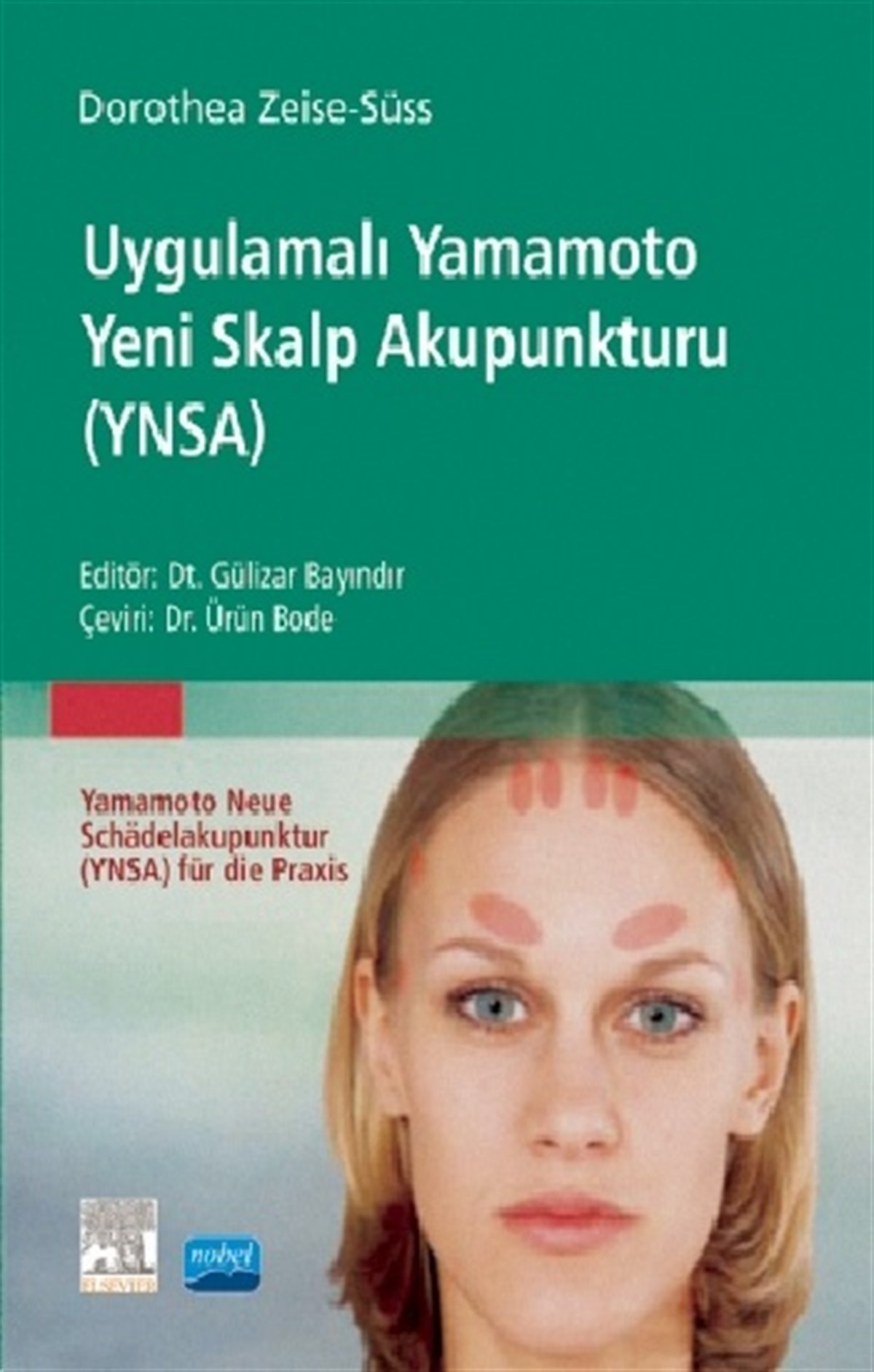 Uygulamalı Yamamoto Yeni Skalp Akupunkturu (YNSA)