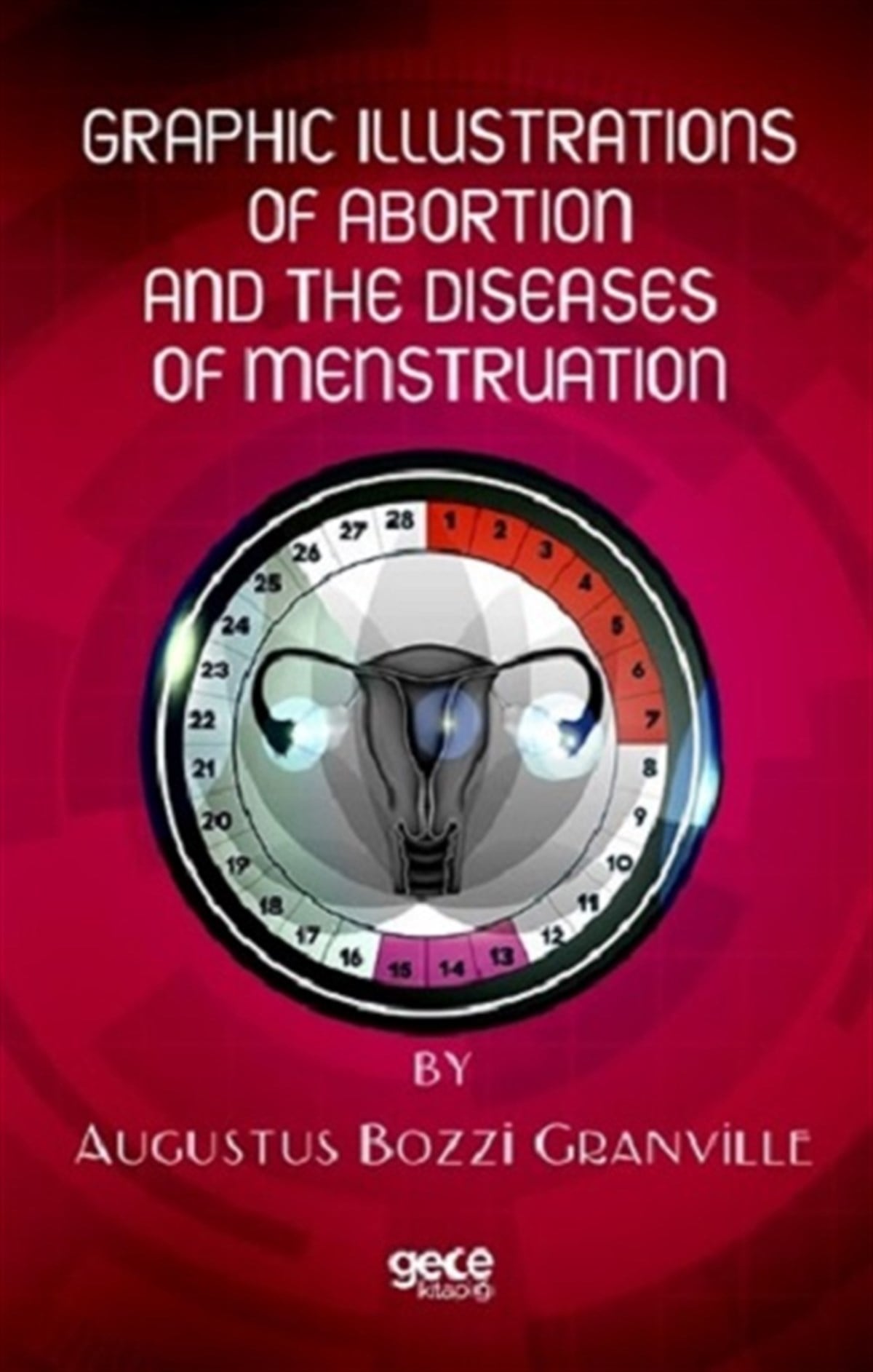 Graphic Illustrations Of Abortion And The Diseases Of Menstruation