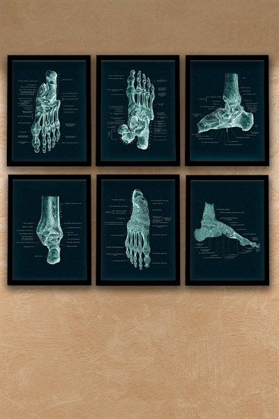 Anatomik Tablo, Doktor Hediyesi, Ortopedi, Ayak Kemikleri, Doktor Odası  Duvar Tablosu 6 lı