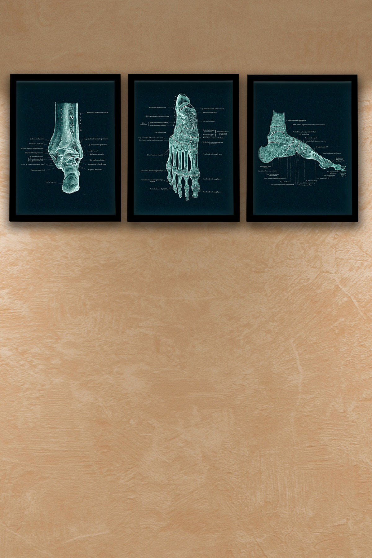Anatomik Siyah Tablo, Ortopedi, Ayak Kemikleri, Doktor Odası  Duvar Tablosu 3 lü