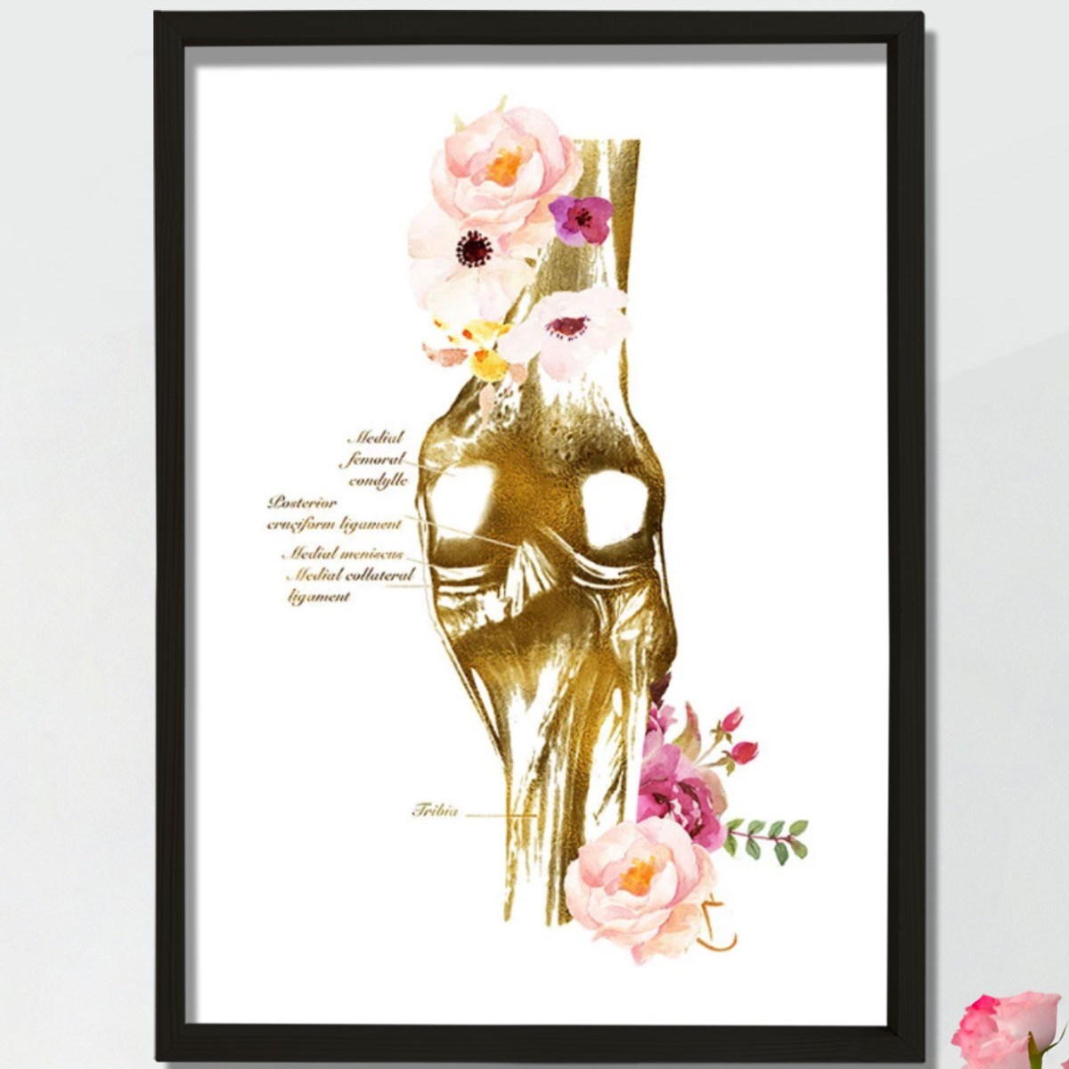 Diz Anatomisi Sanatı, Ortopedi Cerrahı, Fiziksel Terapist Hediyesi