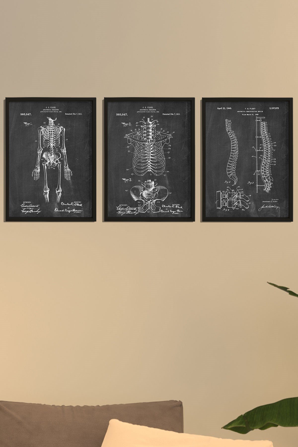 Doğal Çam Çerçeveli Duvar Tablosu İnsan İskelet Anatomi 3'lü Tablo Seti