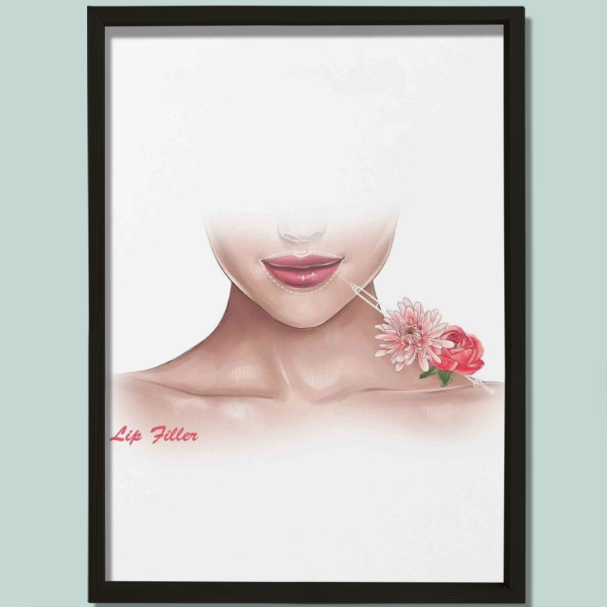 Dudak Dolgusu Büyütme, Rekonstrüktif Cerrahi, Plastik ve Estetik Cerrahı, Doktor Odası Duvar Tablosu