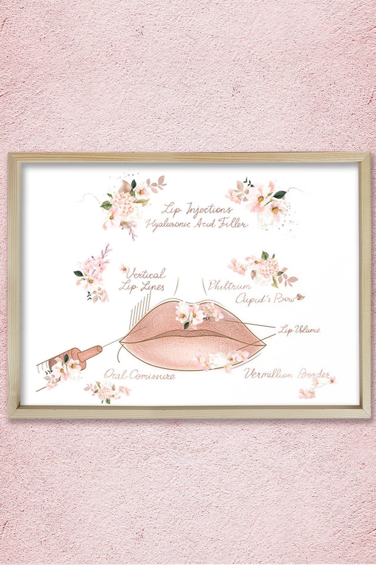 Dudak Dolgusu, Dudak Büyütme, Plastik ve Estetik Cerrahı, Doktor Odası Duvar Tablosu