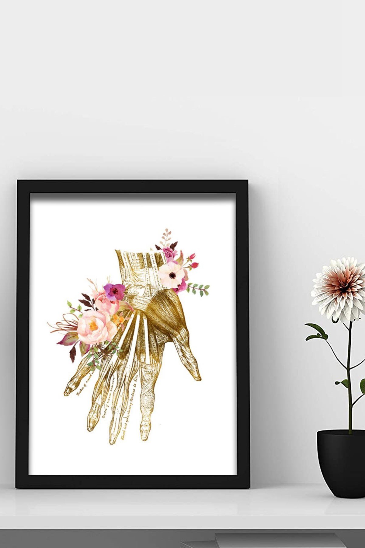 El Kasları Sanatı , Ortopedi, Cerrah, Fizyoterapist  Doktor Odası Duvar Tablosu