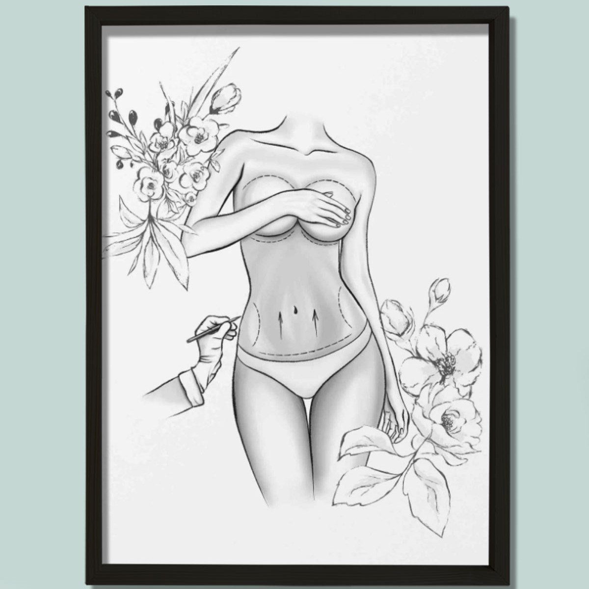 Estetik Ameliyat İşaretleri, Karın Germe, Plastik ve Estetik Cerrahı, Doktor Odası Duvar Tablosu