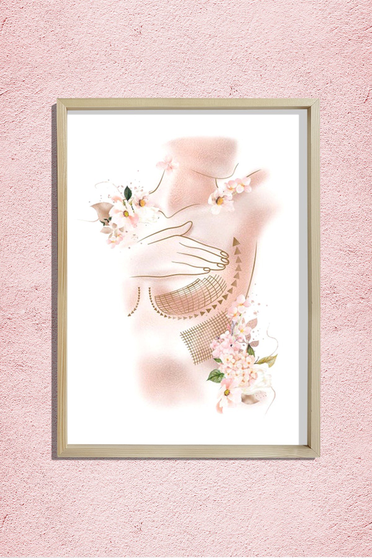 Göğüs Dikleştirme, Göğüs Büyütme, Plastik ve Estetik Cerrahı, Doktor Odası Duvar Tablosu