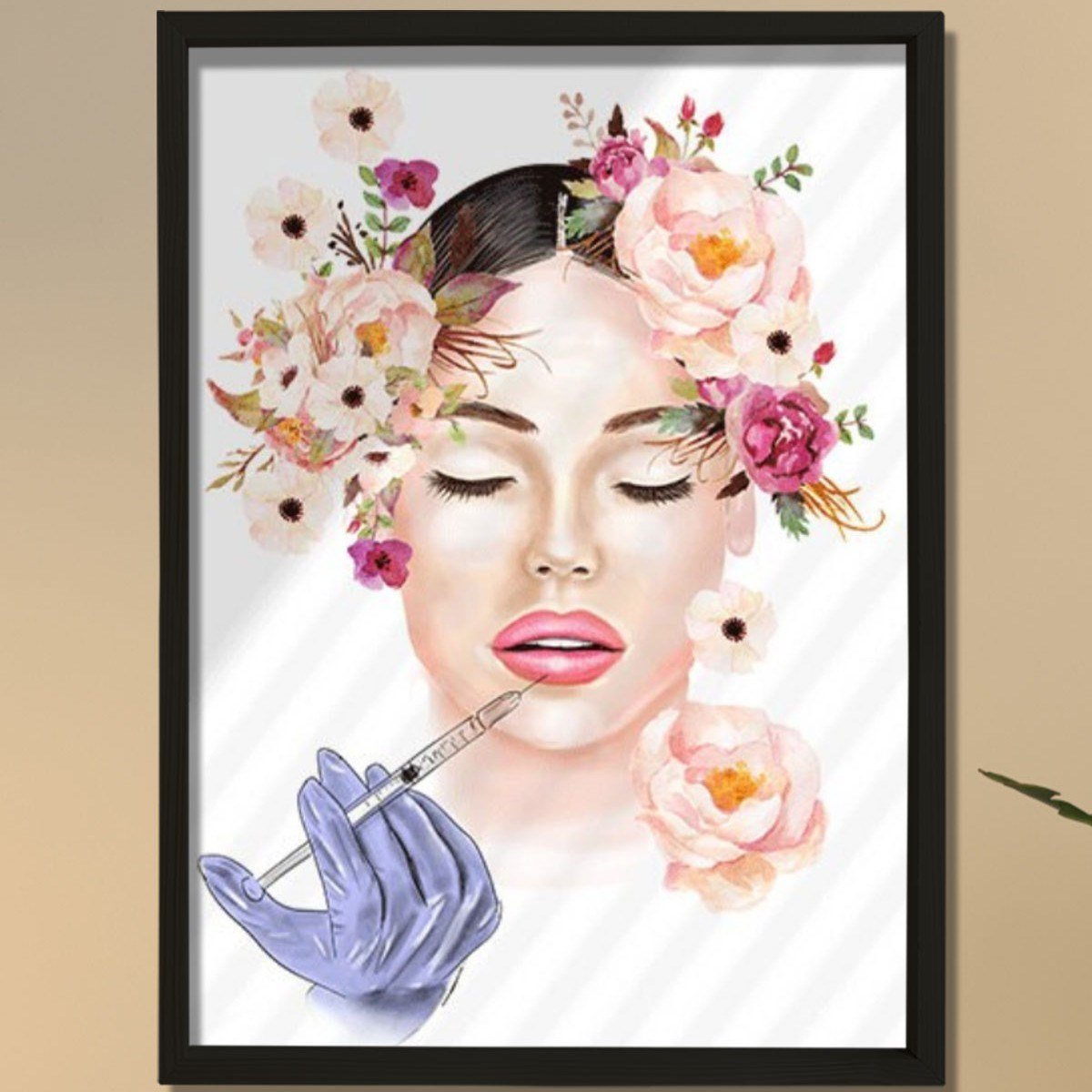 Lip Botox Posteri, Hyaluronik Asit, Estetik Merkez Dekoru