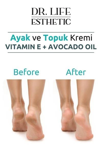 Dr. Life Esthetic Çatlak Onarıcı Ayak ve Topuk Kremi Crack Repair Cream 100 ml