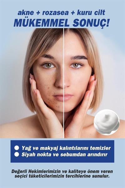 Tto Termal Yüz Temizleme Köpüğü 200 Ml 