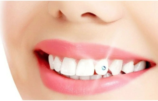 Göz Kamaştıran Gülümsemeler: Dişlerde Pırlanta Trendi