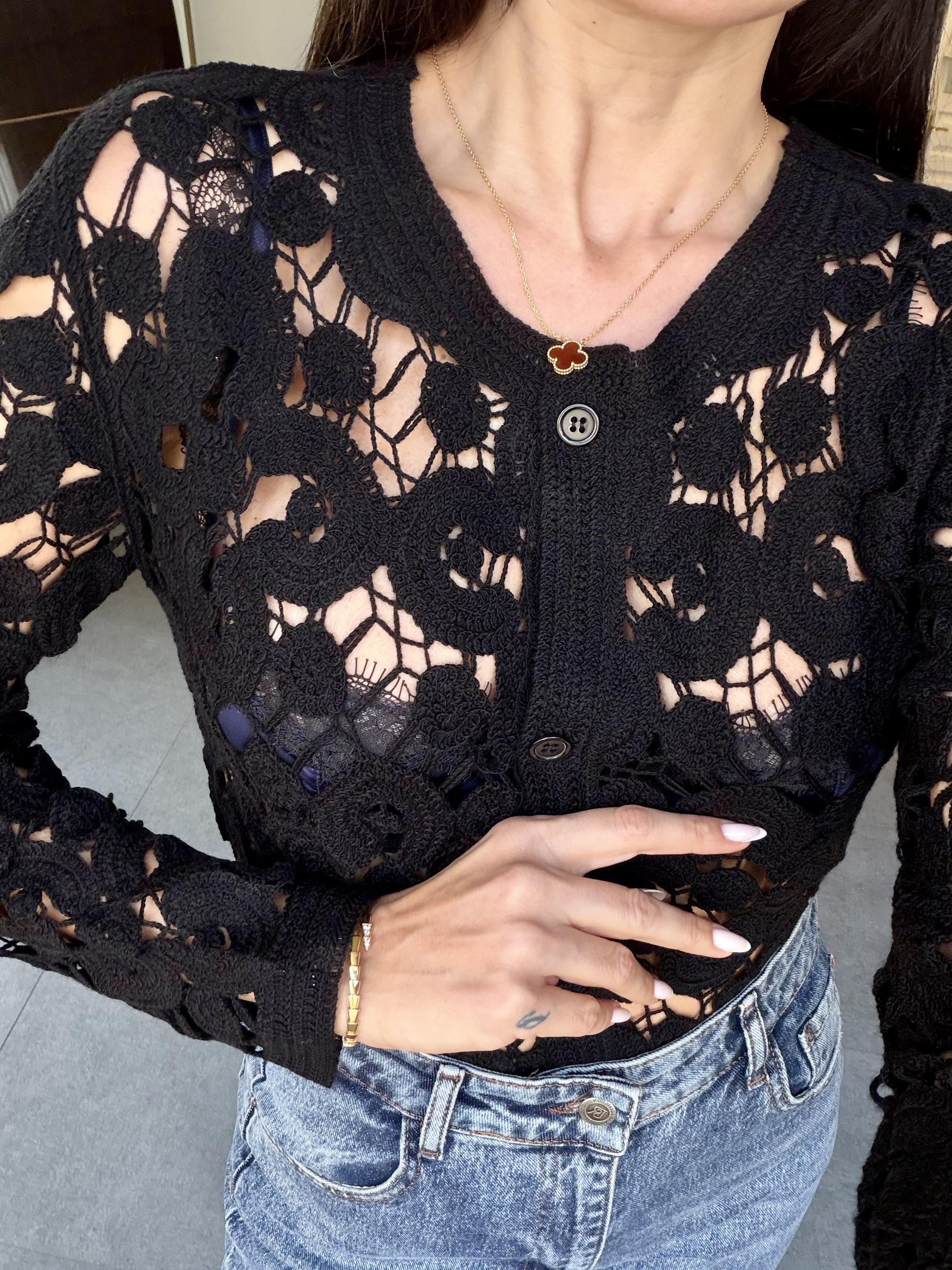 Siyah Dantel Tasarımlı Hırka