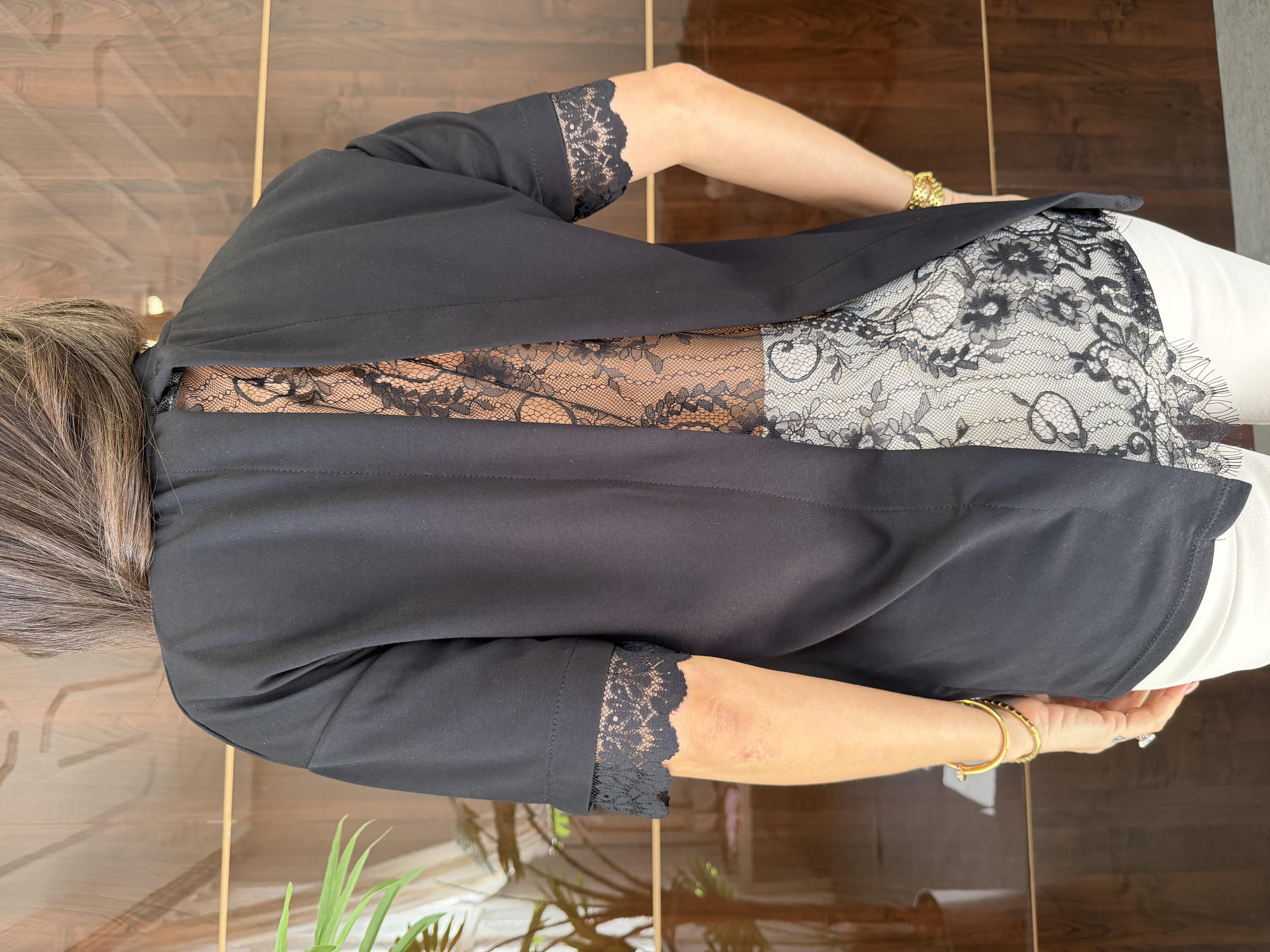 Siyah Dantel Tasarımlı Tişört