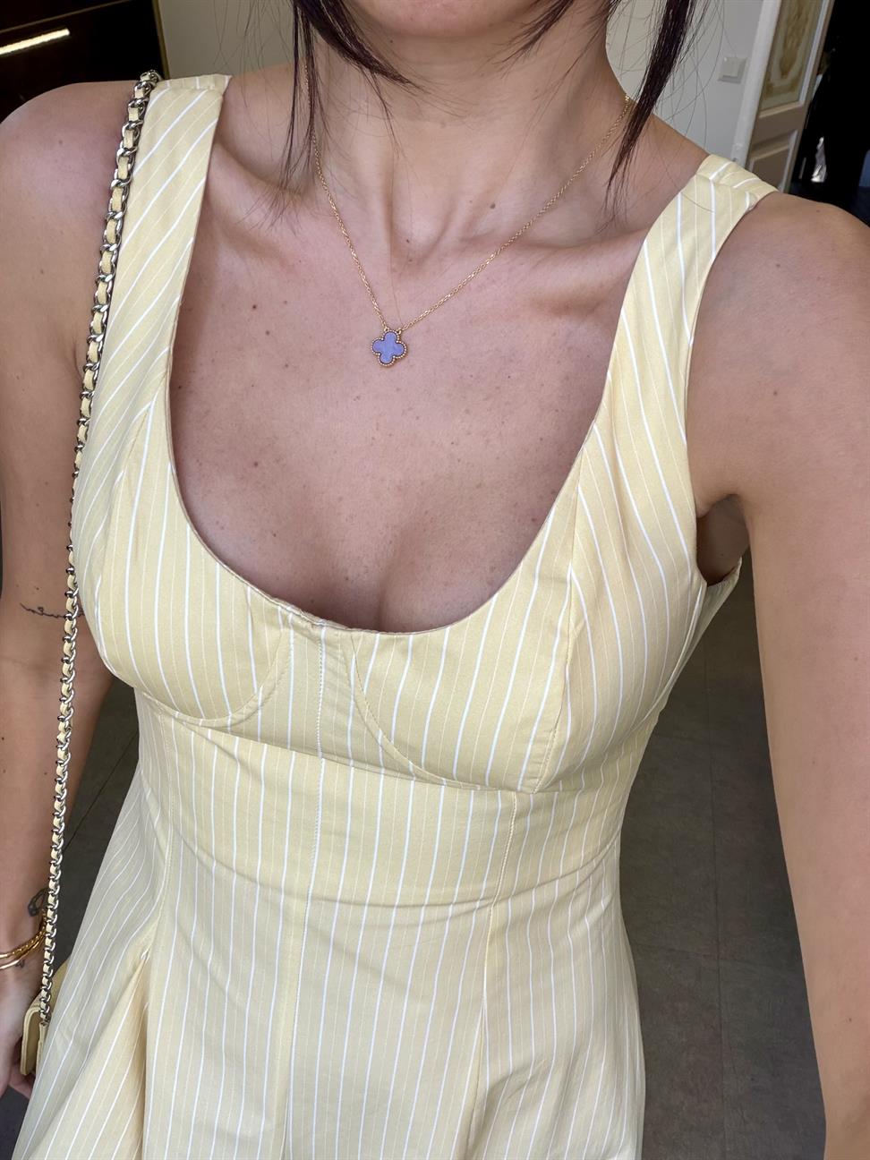 Sarı Tasarım Çizgili Midi Boy Elbise