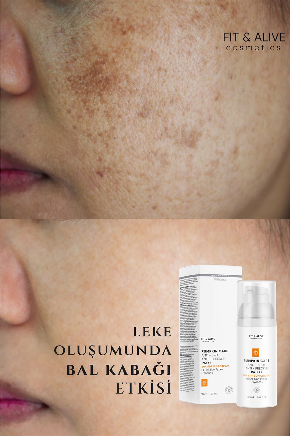 Fitalive Lekeli Ciltlere Özel Aydınlatıcı Pumpkin Güneş Kremi SPF 50+ (Anti  Spot & Anti Freckles)