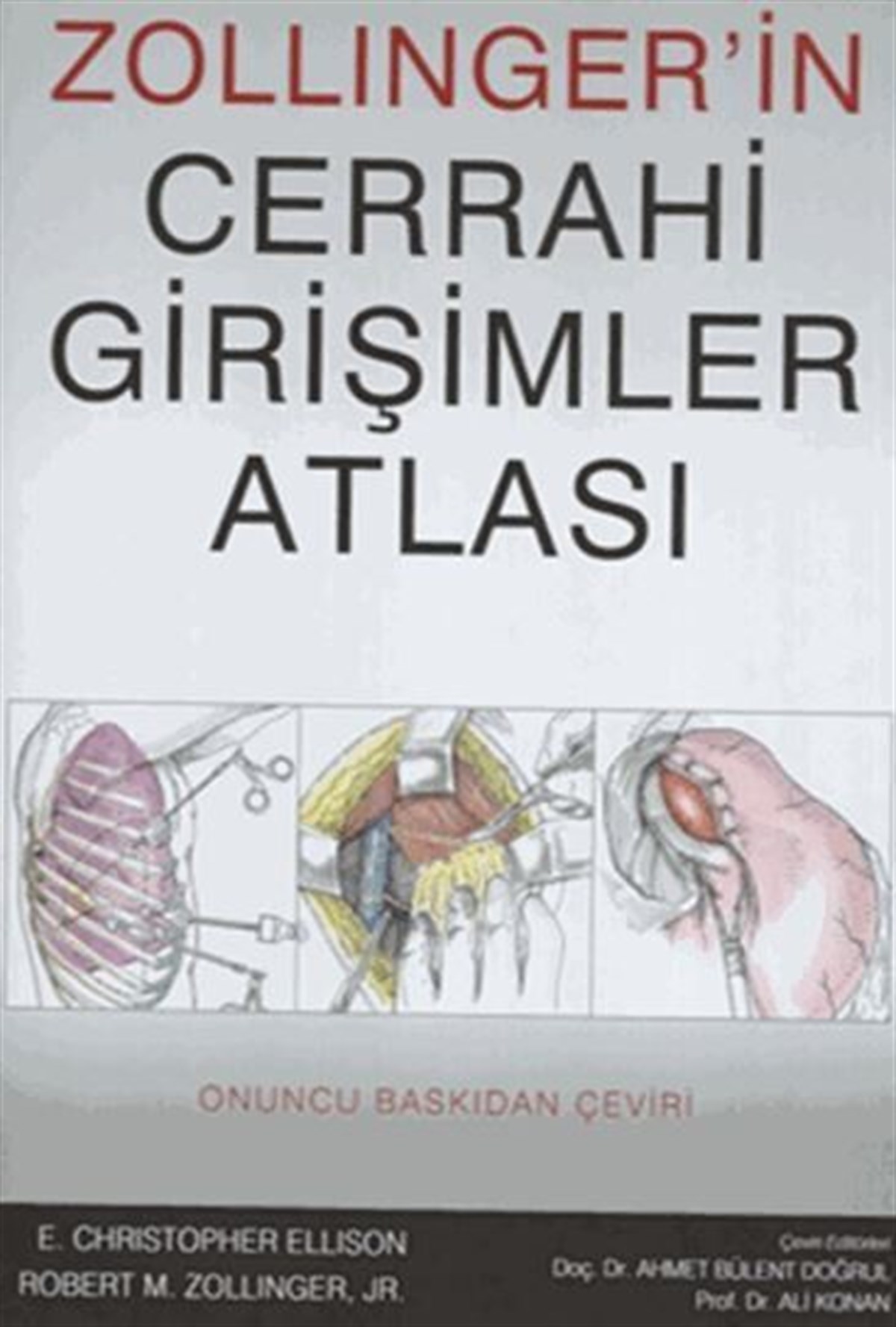 Palme Yayınları Zollingerin Cerrahi Girişimler Atlası
