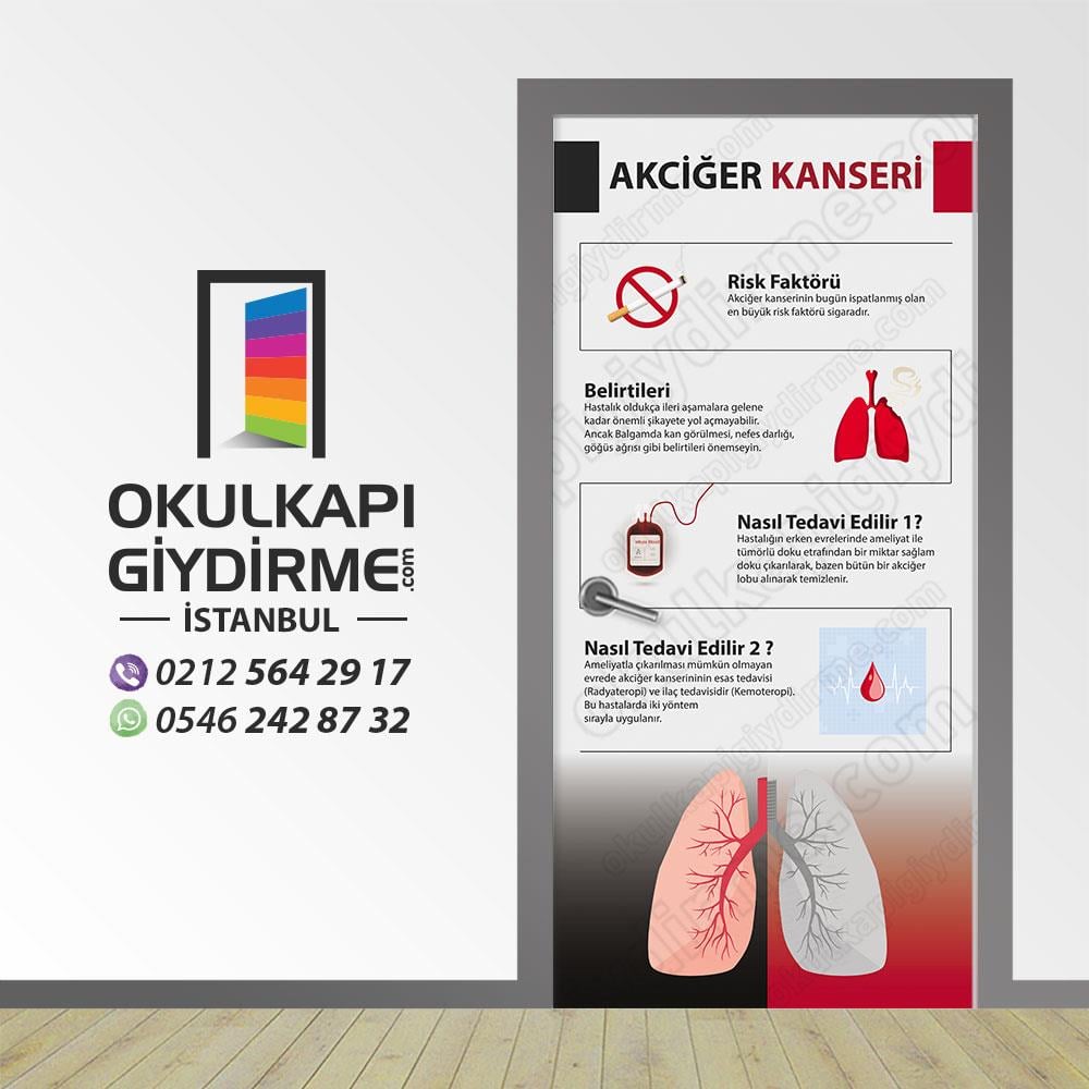 Kapı Giydirme Akciğer Kanseri KG S 16