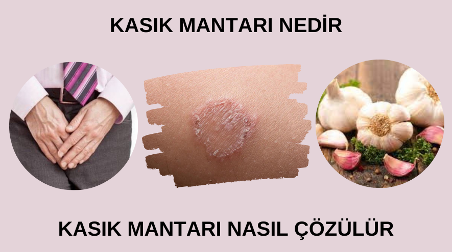 kasık mantarı