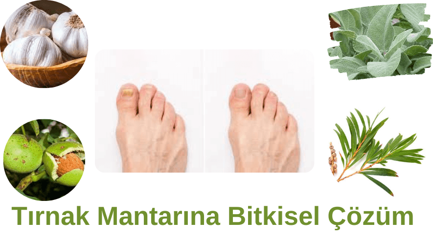 Tırnak mantarı nasıl geçer