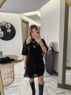 Siyah Dantel Detaylı Tişört-0771