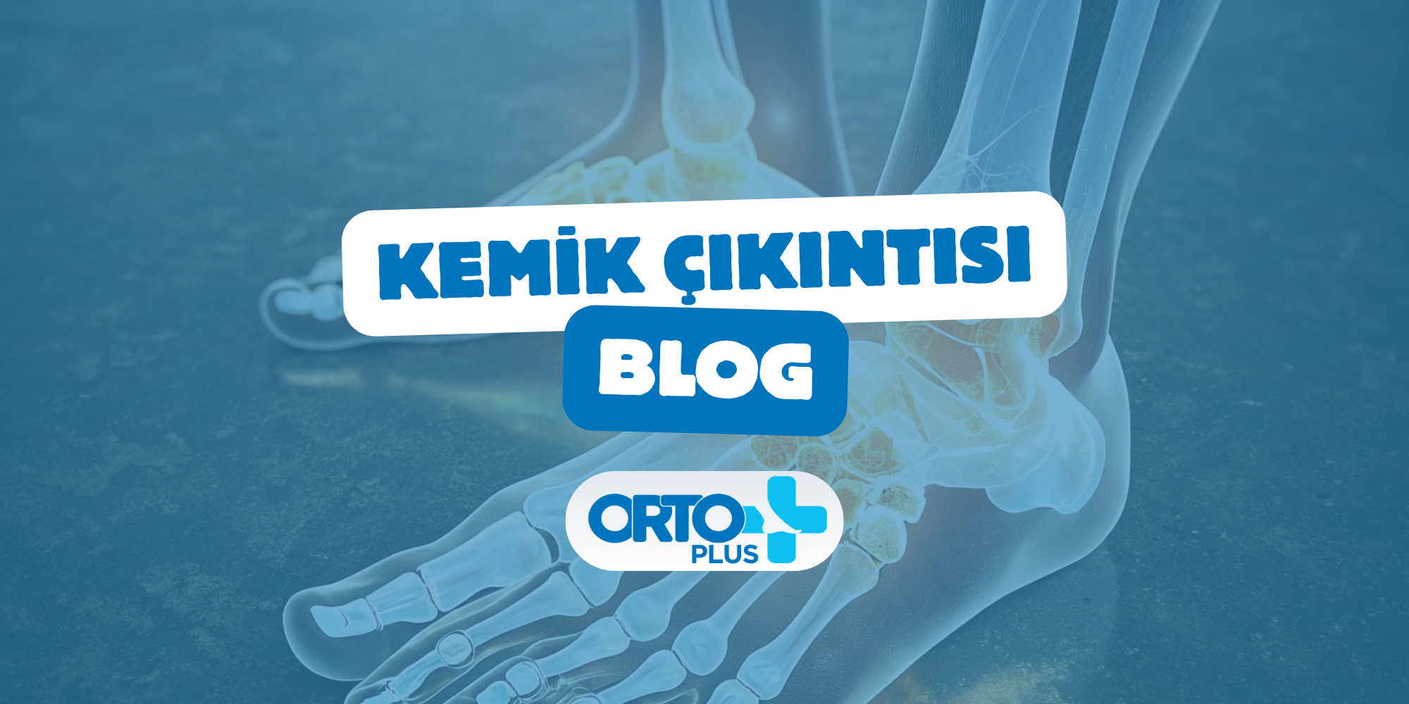 Kemik Çıkıntısı