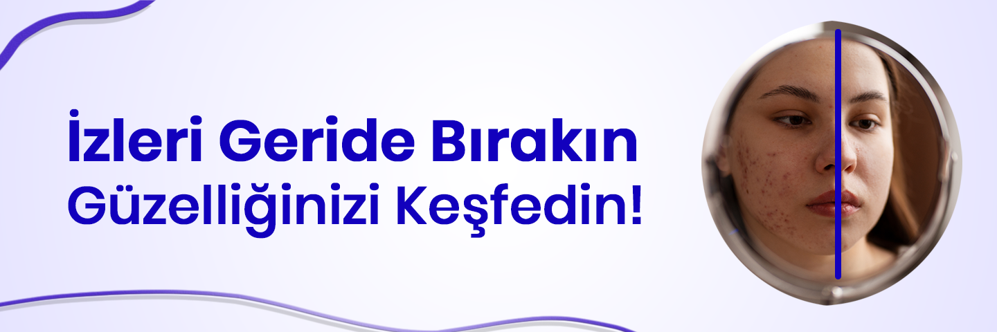 sivilce-izlerinden-kurtulma