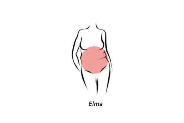 Elma Vücut Tipi Nasıl Zayıflar