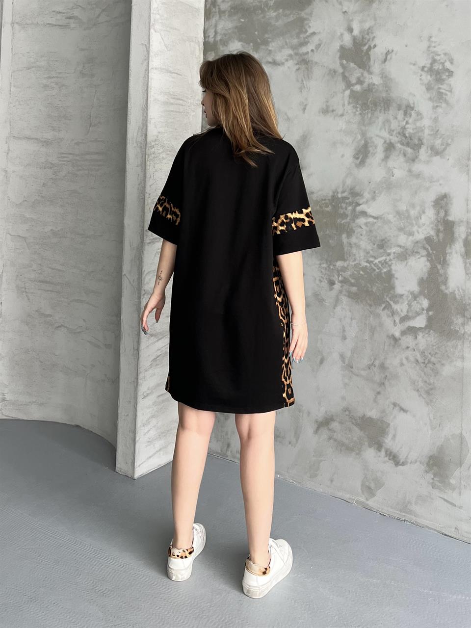 NYC Nakışlı Siyah Tunik