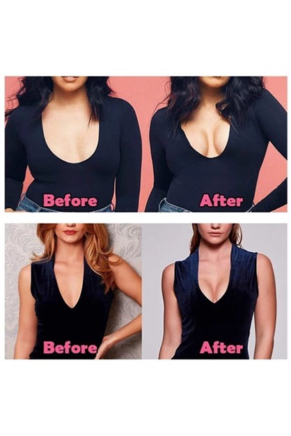 C&City Boob Tape Breast Lift Tape With 2 Pcs