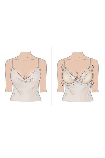 Ultra Thin Strapless Adhesive Bra 7238