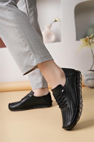 Castle Black 22384 Siyah Hakiki Deri Şeffaf Taban Kadın Sneakers