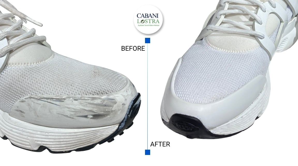 Cabani Lostra Before After 8