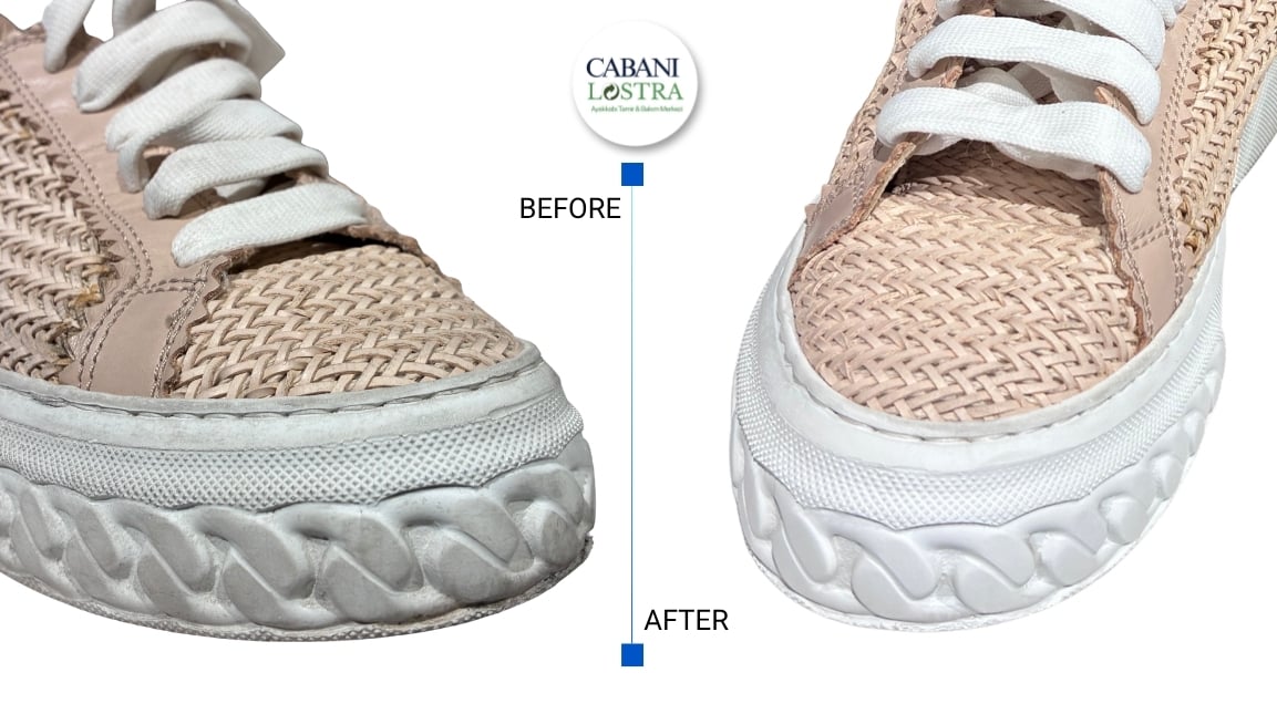 Cabani Lostra Before After 9
