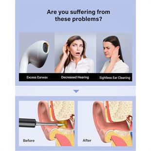 BEBIRD T5 3MP KAMERA 3.5MM LENS ŞARJLI WIFI GÖRÜNTÜLÜ KULAK TEMİZLEYİCİ SİYAH RENK