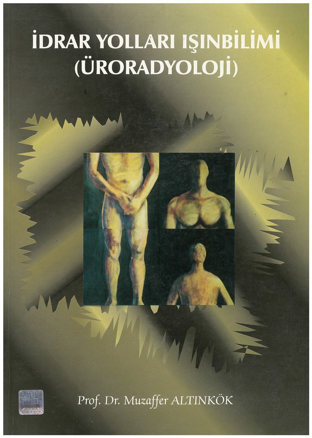 İdrar Yolları Işınbilimi (Üroradyoloji)