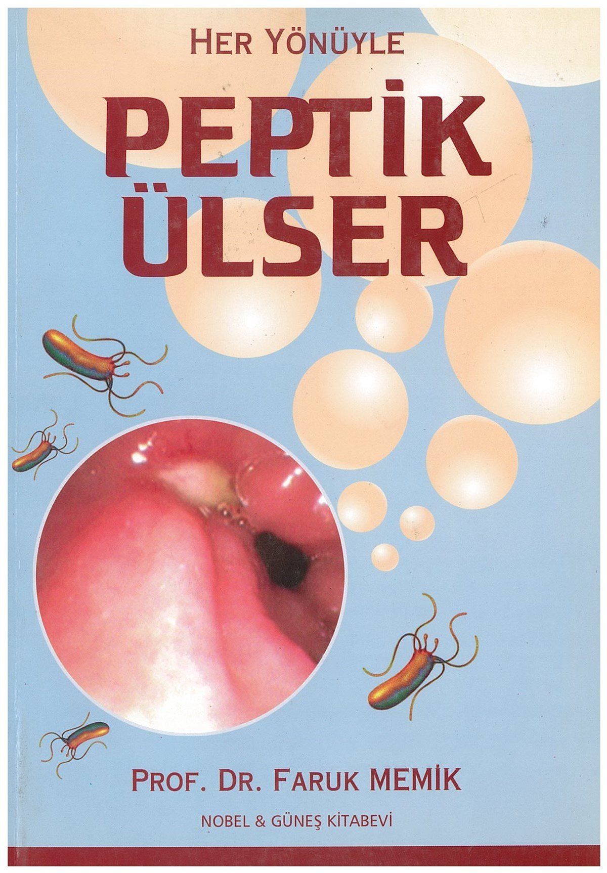 Her Yönüyle Peptik Ülser
