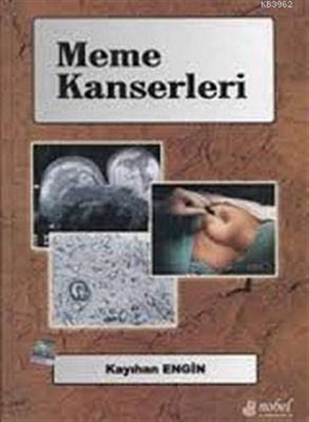 Meme Kanserleri