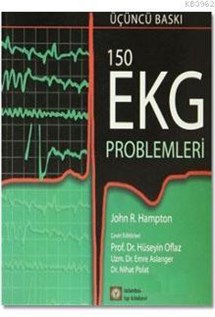 150 EKG Problemleri