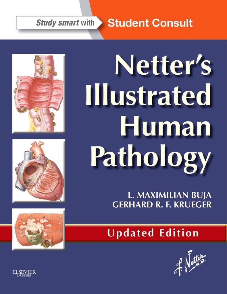 Netter's Illustrated Human Pathology Updated Edition L. Maximilian Buja