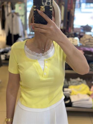 7366 Dantel Yaka Tişört Sarı