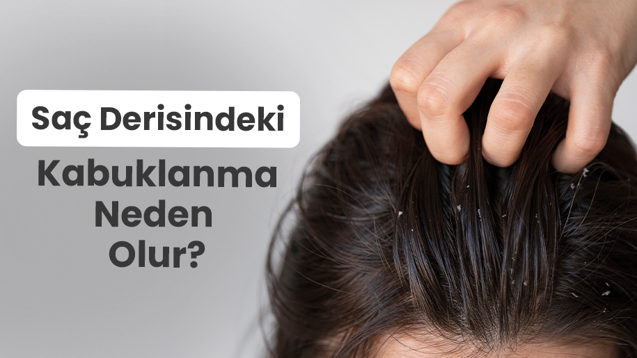 Saç Derisinde Kabuklanma Neden Olur? Nasıl Geçer?